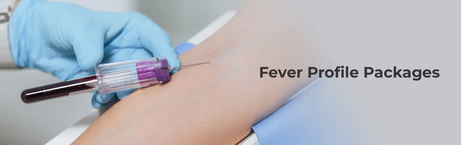 Fever Profile Packages Are They Worth It[1] 