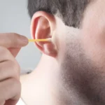 Why Professional Ear Syringing Can Be the Right Choice for Stubborn Earwax
