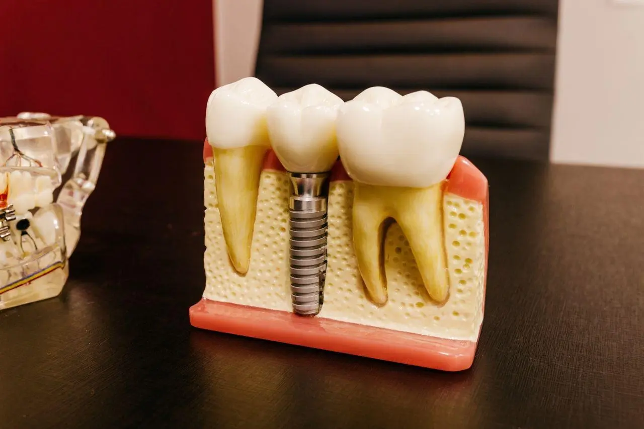 3 Red Flags You're Rushing Your Smile Restoration Treatment Plan