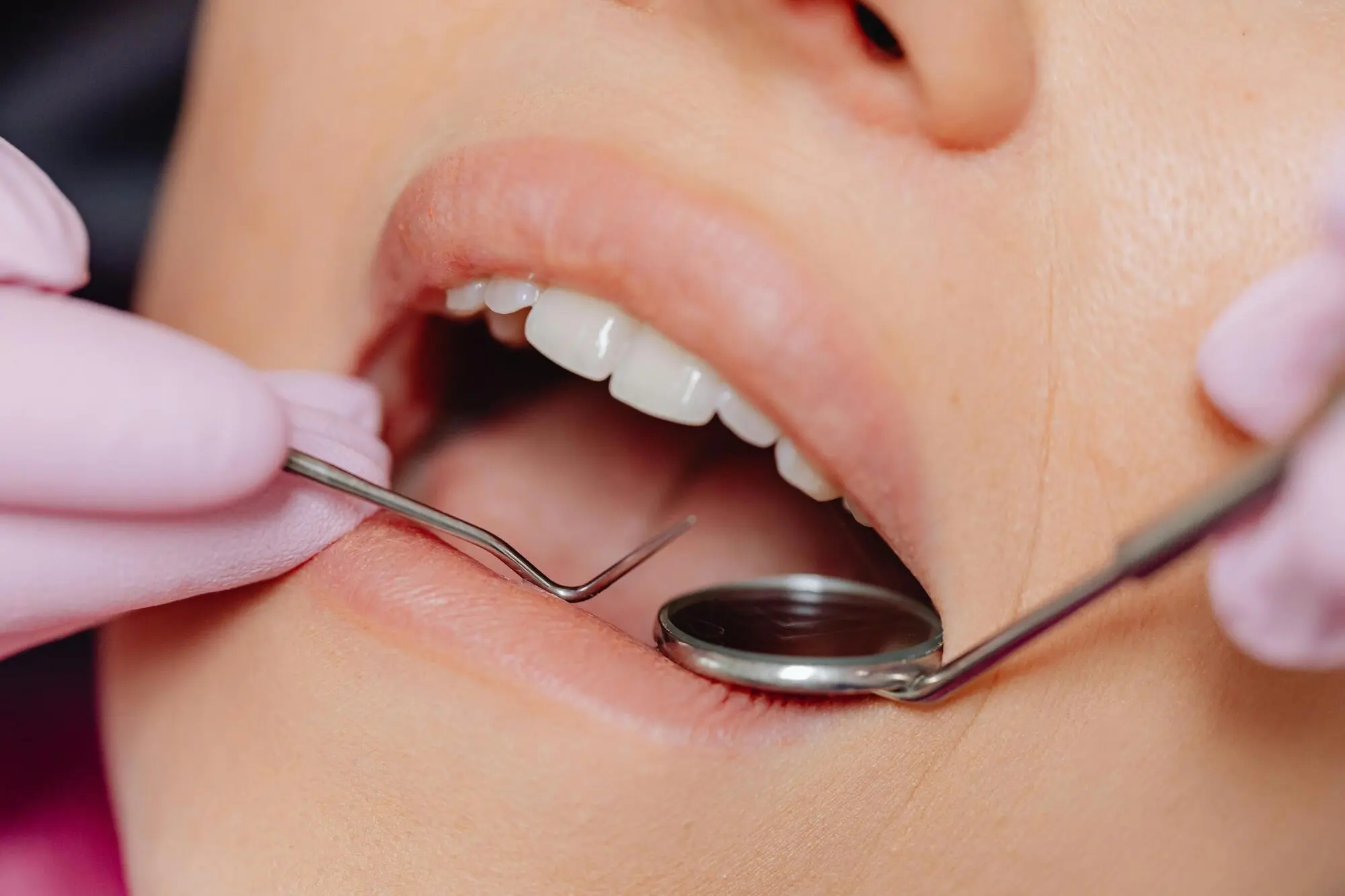 Reasons You May Need Oral Surgery