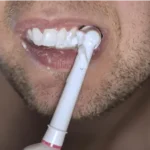 Common Causes of Damaged Teeth and Remedies