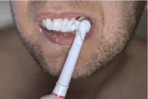 Common Causes of Damaged Teeth and Remedies